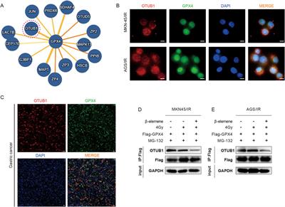 β-Elemene promotes ferroptosis and reverses radioresistance in gastric cancer by inhibiting the OTUB1-GPX4 interaction